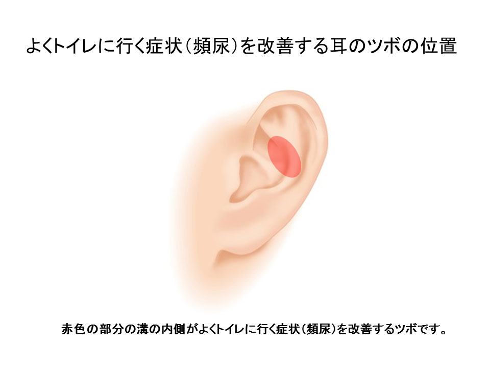 よくトイレに行く症状の耳つぼの位置（圧縮）